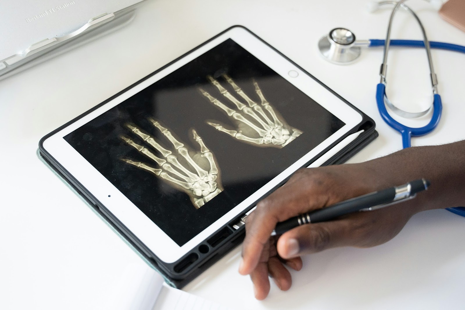 Smart tablet displaying X-ray diagnostic images of hands
