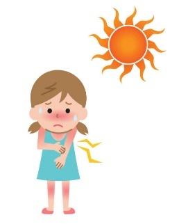 Sunburn And Girl Kid Illustration Health Care Concept In Summer Stock Illustration - Download Image Now - iStock
