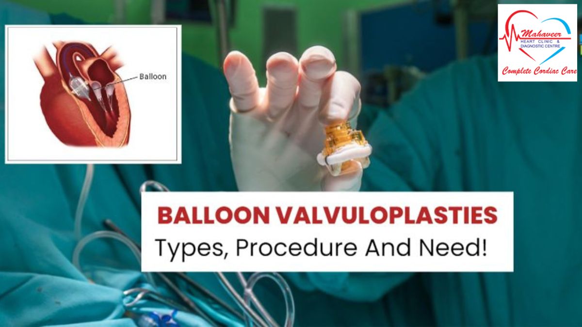 Balloon-Valvuloplasties-Dr Rakesh Jain-Indore Cardiologist
