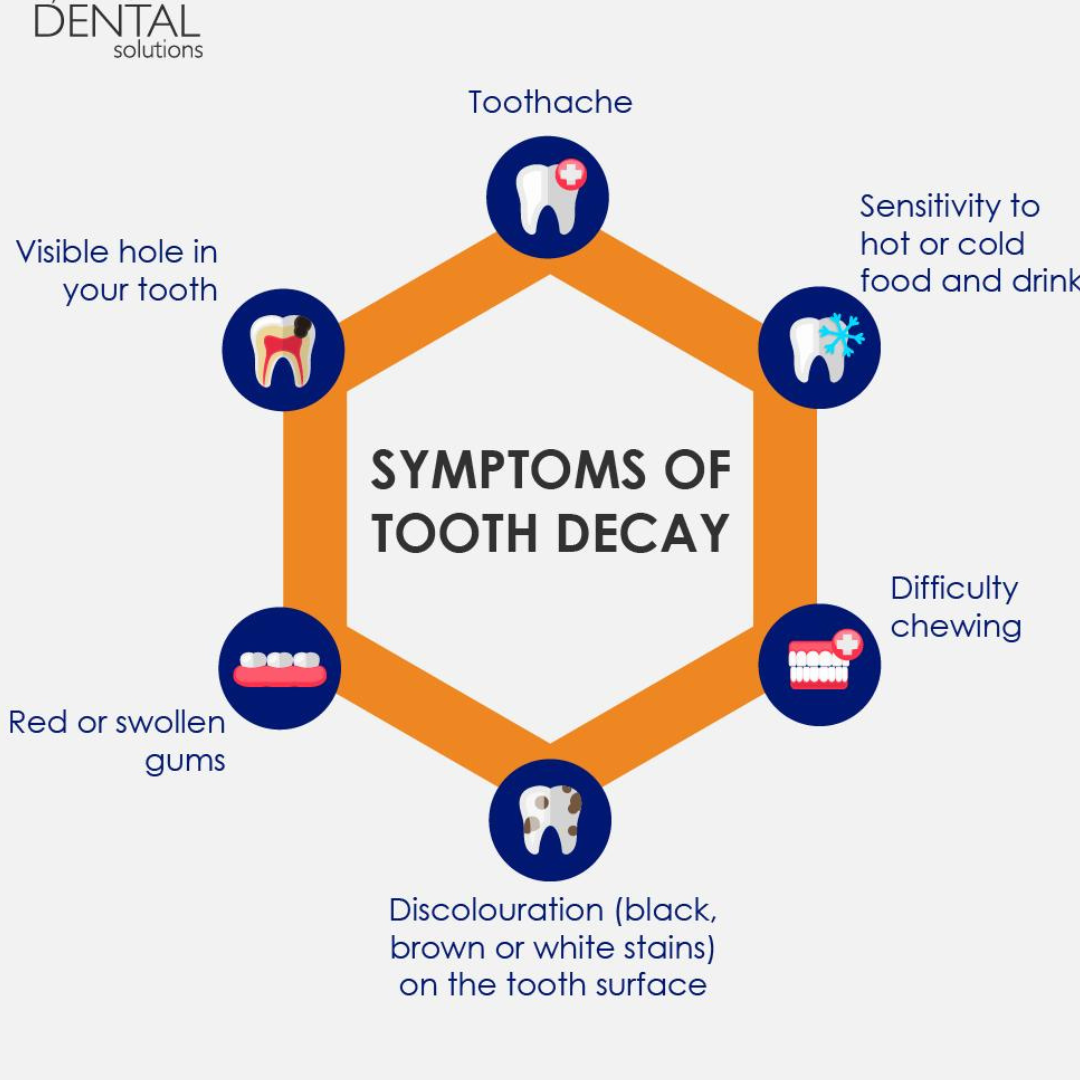 The Hidden Dangers of Bad Dental Fillings and How to Address Them