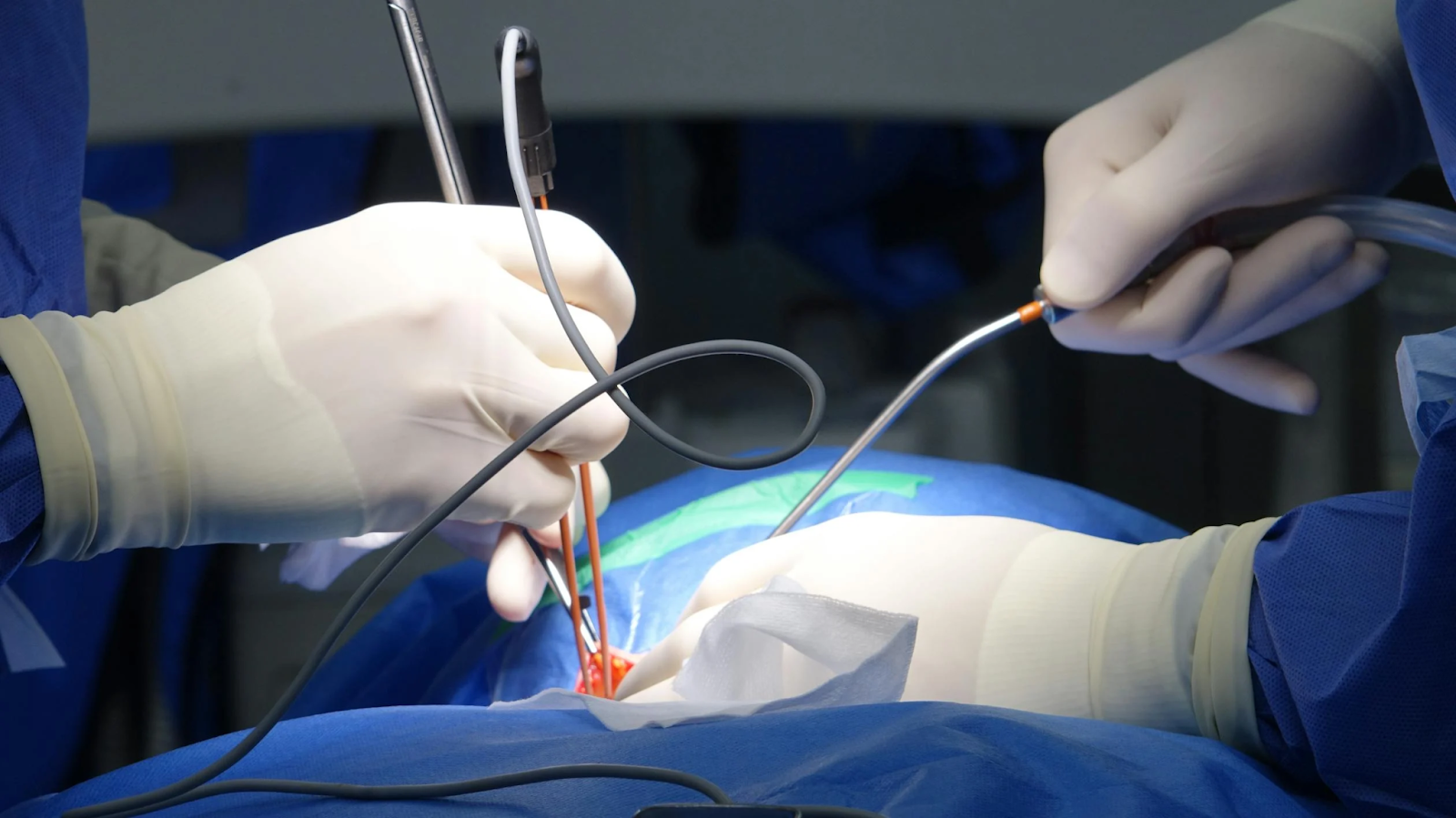 surgical procedure with medical instruments