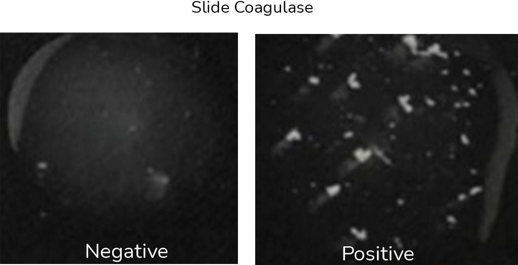 Slide Coagulase Test / Clumping Factor