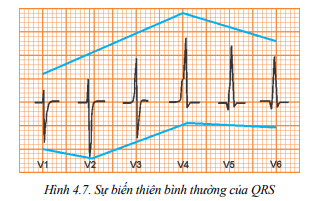 A graph with lines and a blue line

Description automatically generated