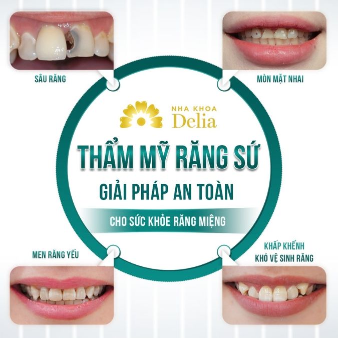 Các trường hợp nên làm răng sứ Cercon HT