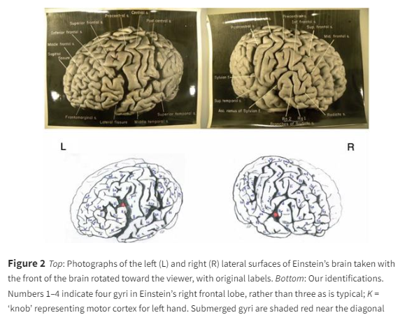 A close-up of a brain

Description automatically generated