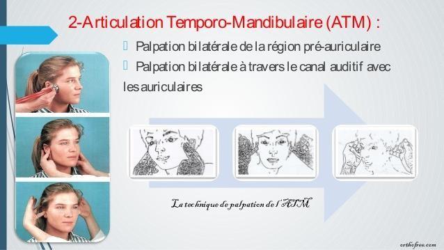PALPATION DE L'ATM.jpg