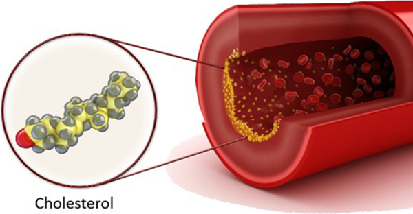 Melhorando os níveis de colesterol no sangue