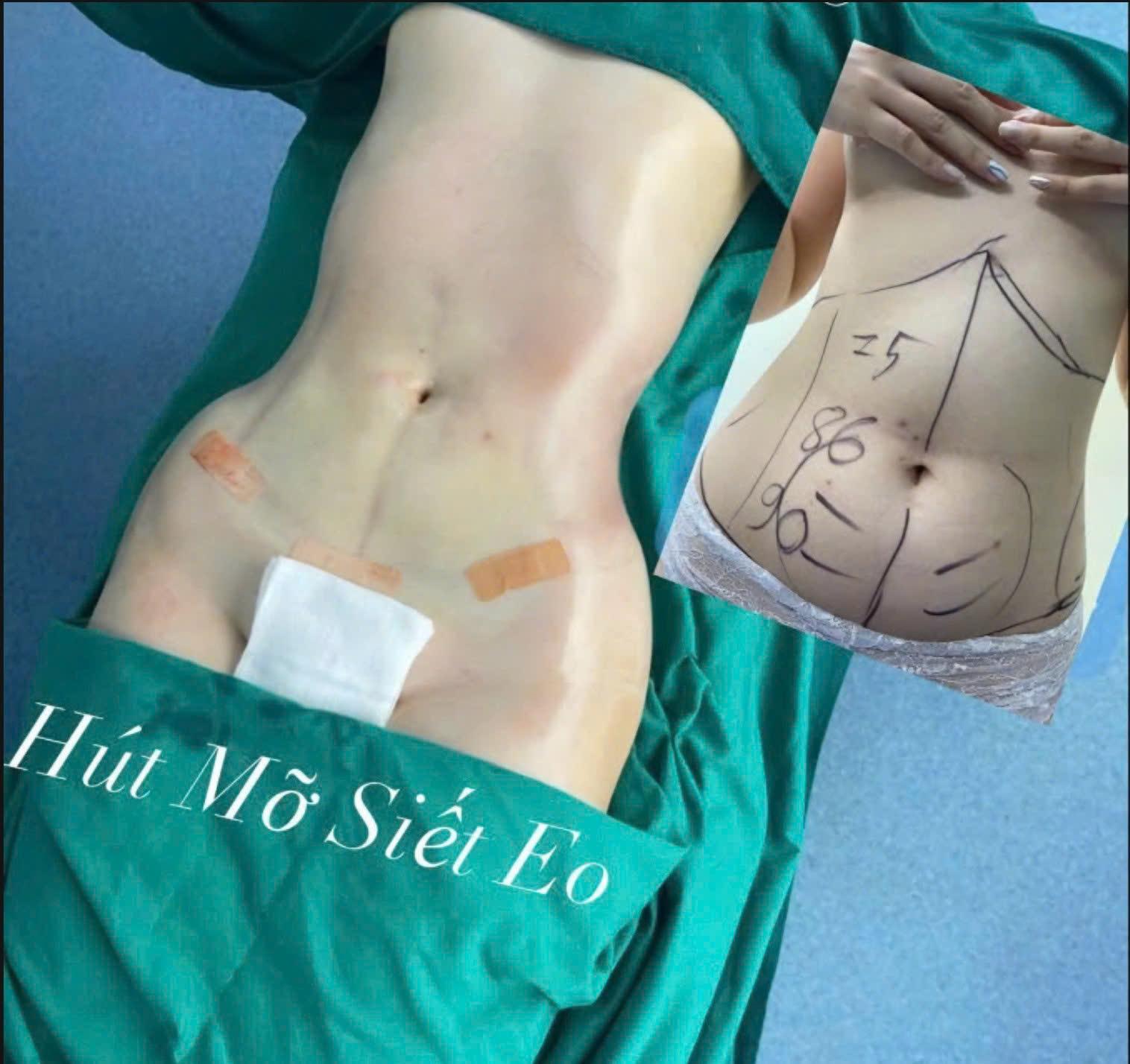 A person's stomach with a drawing on itAI-generated content may be incorrect.