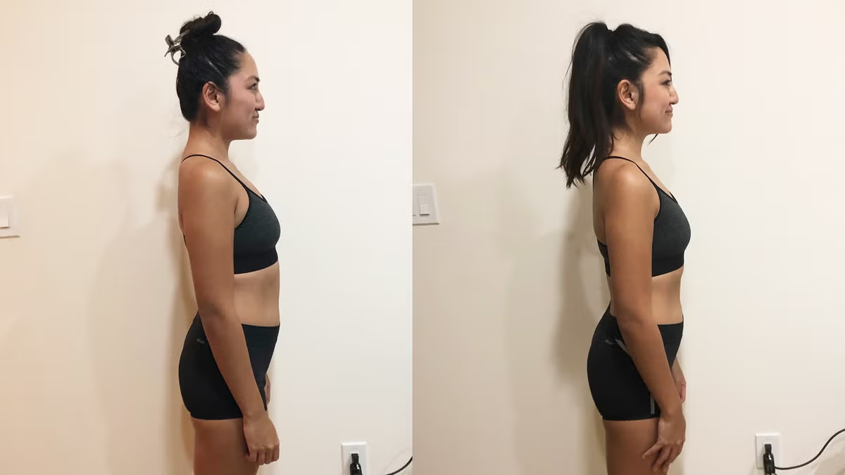  Before and after transformation photos