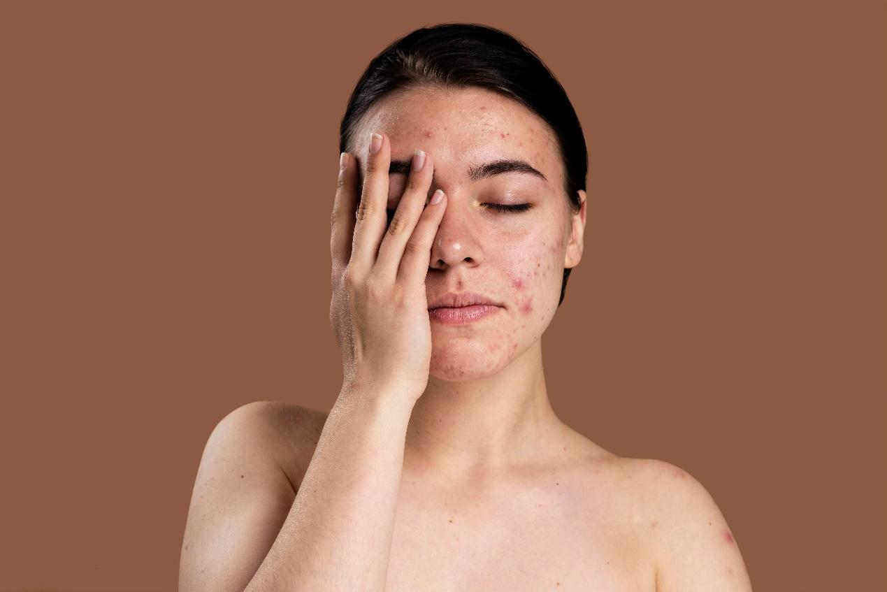 A person with her hand over her face

Description automatically generated