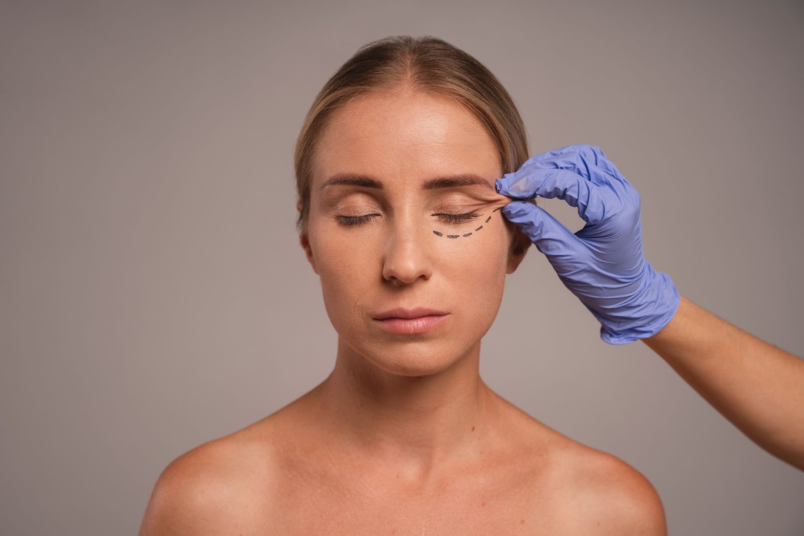 botox under eye 