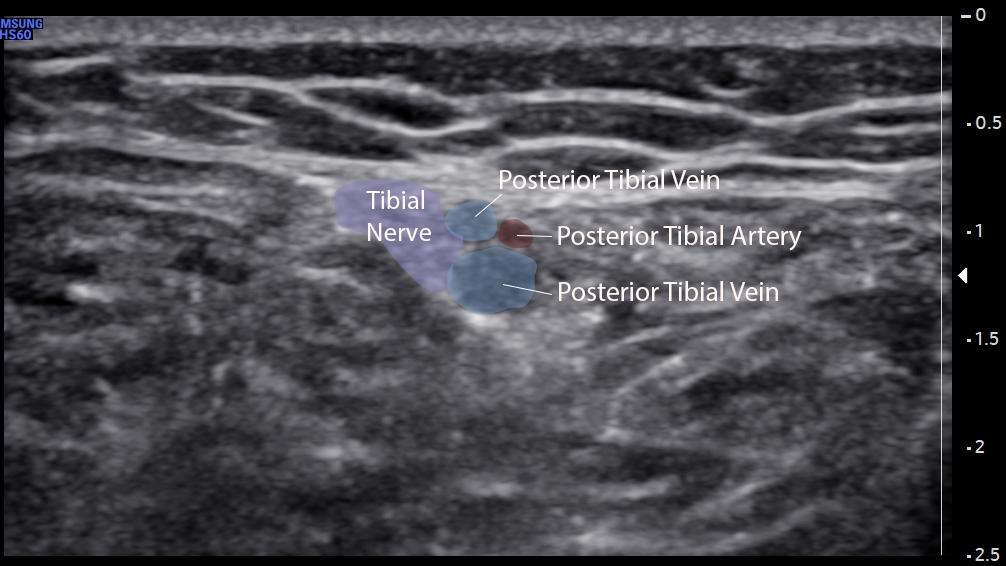 A medical image of a uterus

Description automatically generated with medium confidence