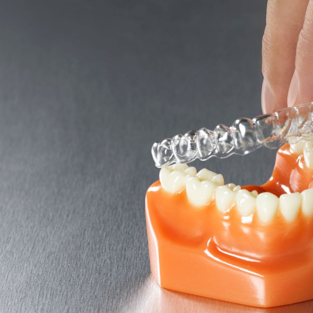 Night Guard vs Retainer: Which is Best for Teeth Protection?