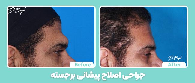 A person's face before and after hair loss

AI-generated content may be incorrect.