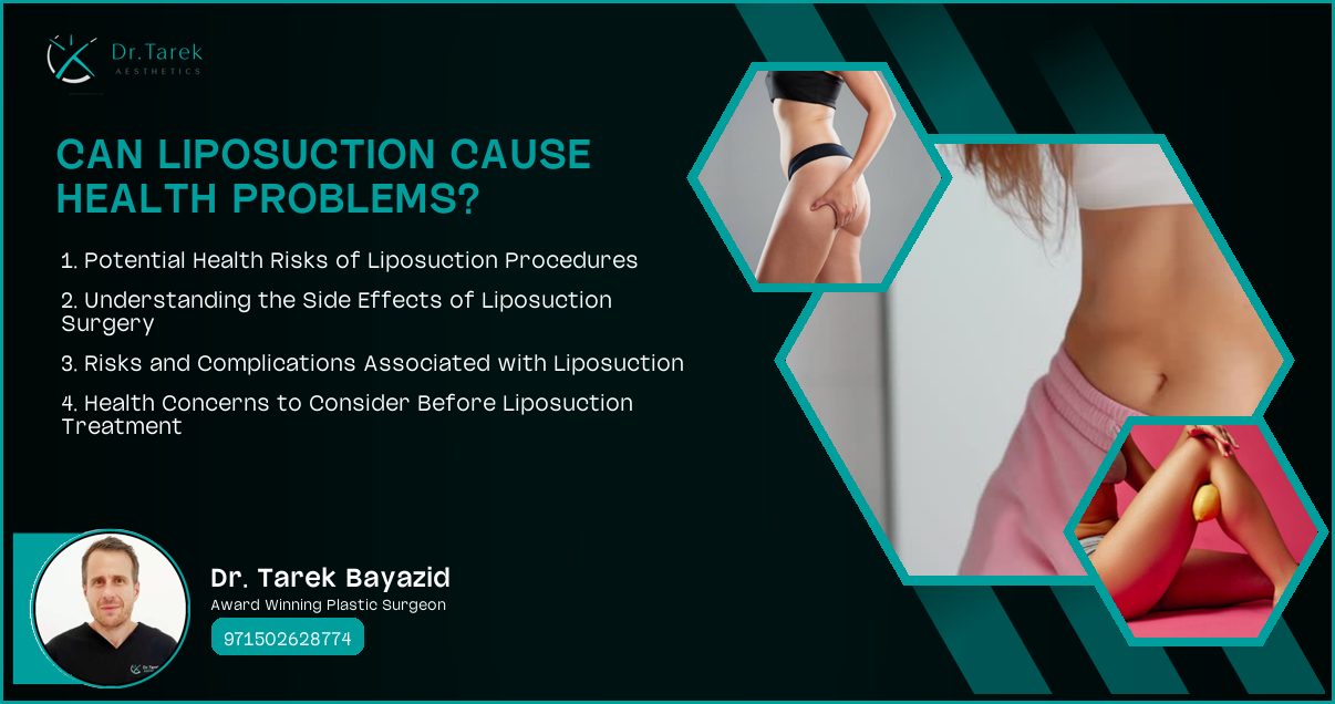 Can Liposuction Cause Health Problems