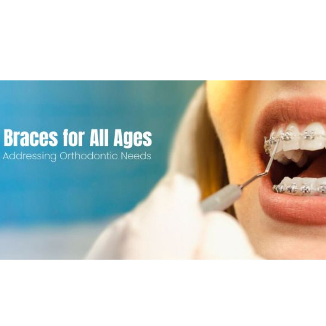 Discover the Best Orthodontists for Your Perfect Smile