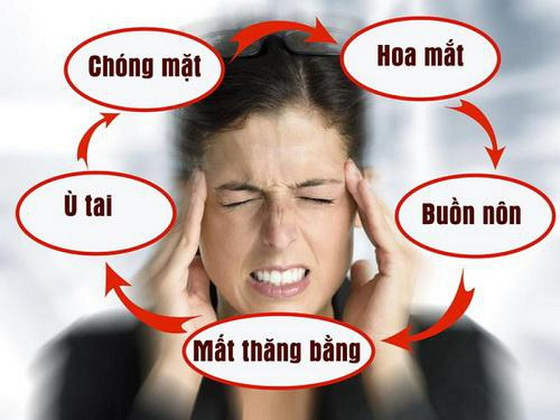  Khi có các dấu hiệu chóng mặt, đau đầu bất thường cần đi khám rối loạn tiền đình ngay