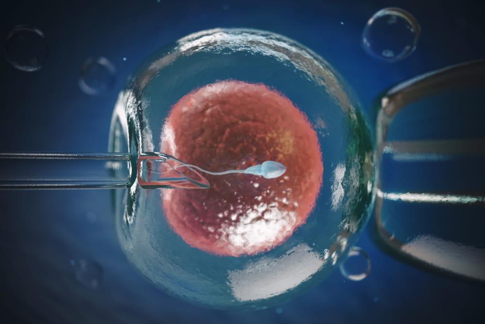 Fertilização in vitro (FIV): o que é e como é realizada?