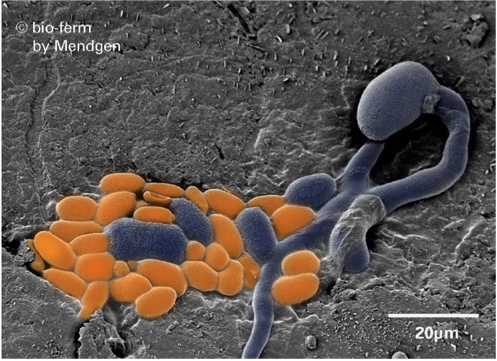 https://ilblogdellasci.wordpress.com/2016/06/10/il-biorisanamento-dei-suoli-bioremediation/
