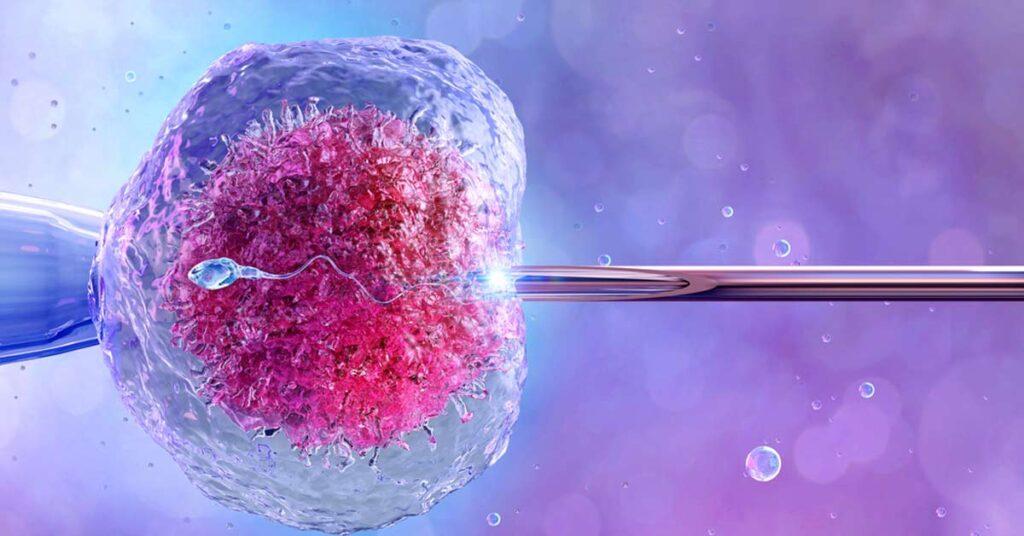 Inseminação Artificial: Guia Completo 2025
