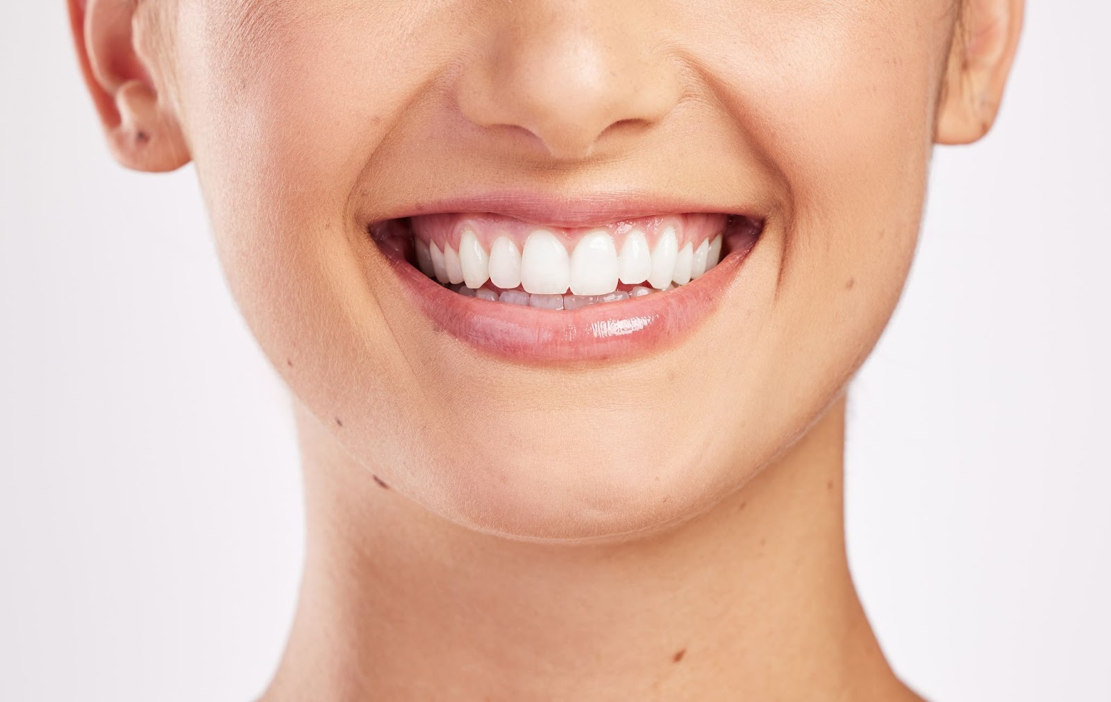 a woman with white teeth is smiling.