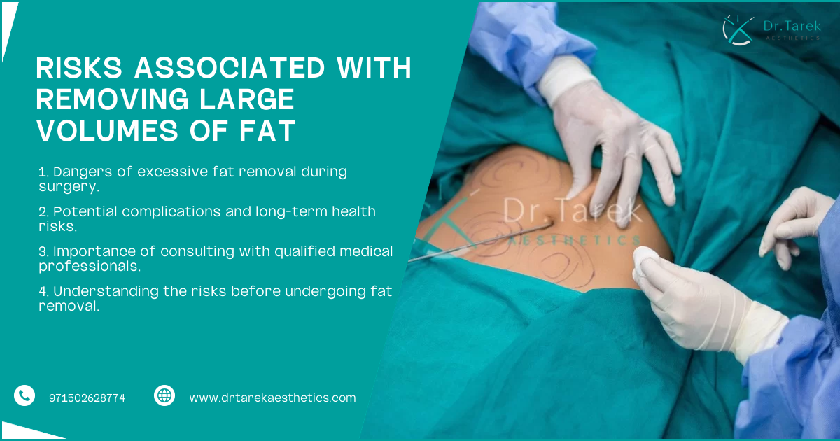 Liposuction 4 Liters Of Fat