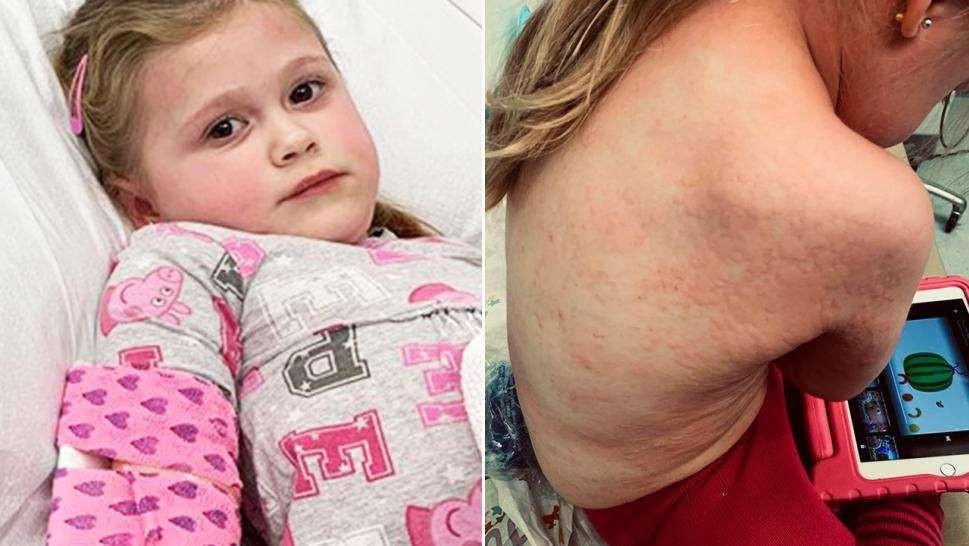 C:\Documents and Settings\Administrateur\Mes documents\032019-anaphylaxis-1280x720.jpg