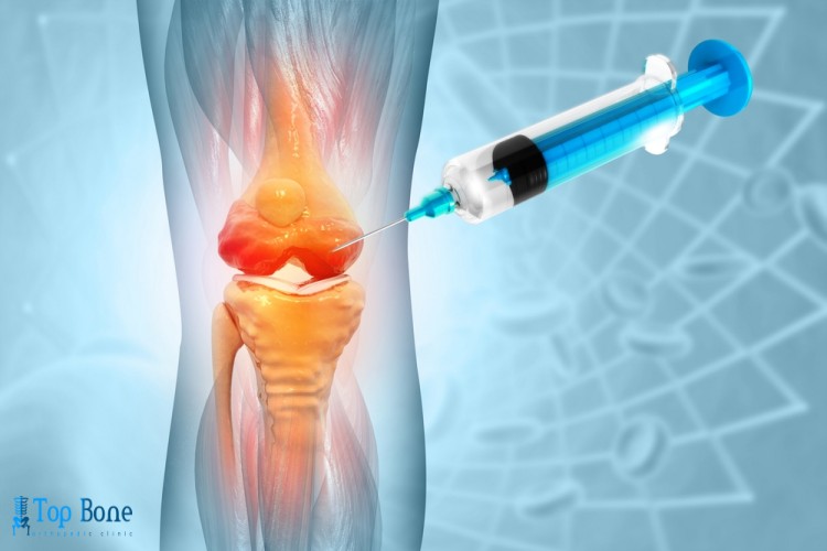 علاج تجمع السوائل في الركبة