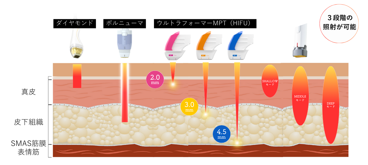 たるみ治療のアプローチ層