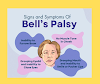 Signs and symptoms of bell's palsy