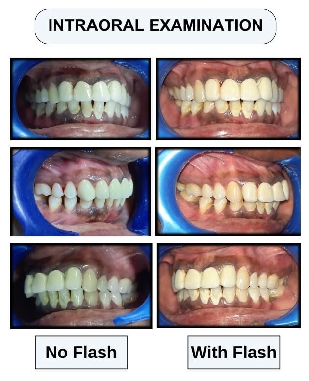 intraoral examinations