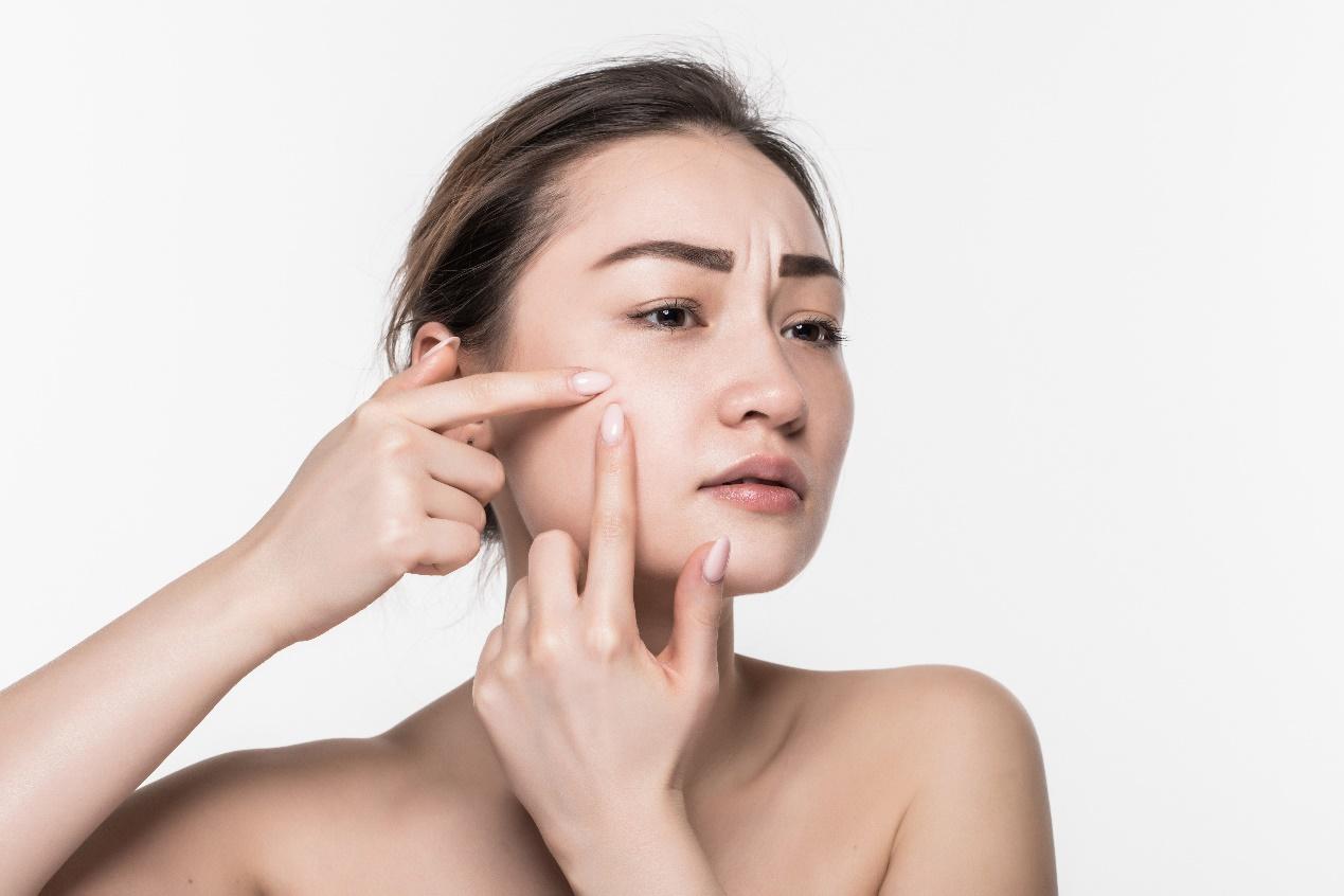 A person pointing at her face

Description automatically generated