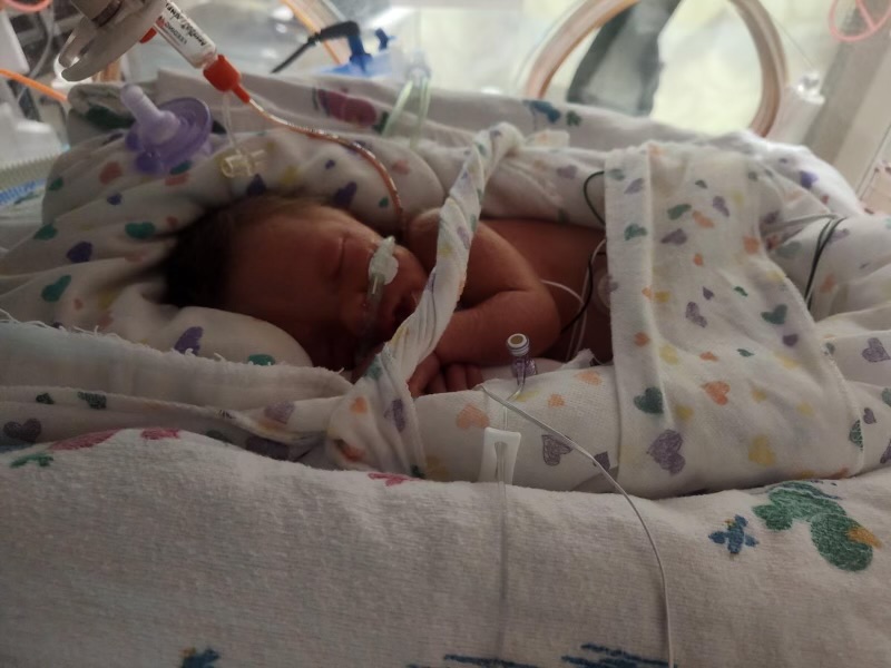 Baby in the NICU in bed.