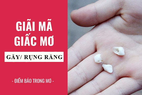 Giải Mã Giấc Mơ Rụng Răng: Bí Mật Con Số May Mắn