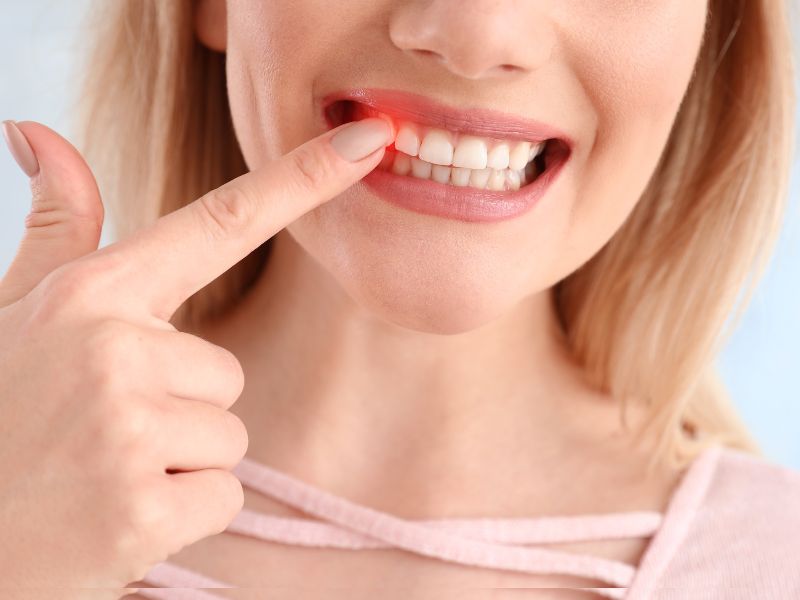 o que é doença periodontal conceito