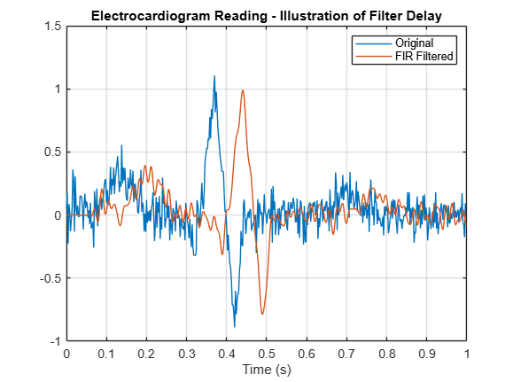 Electrocardiogram reading illustration of filter delay