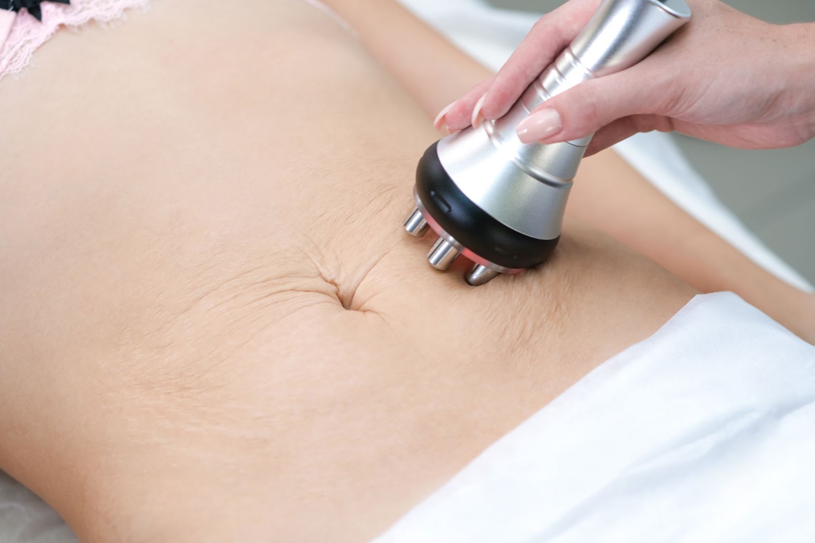 A patient undergoes RF therapy on their stomach to tighten loose skin after weight loss.