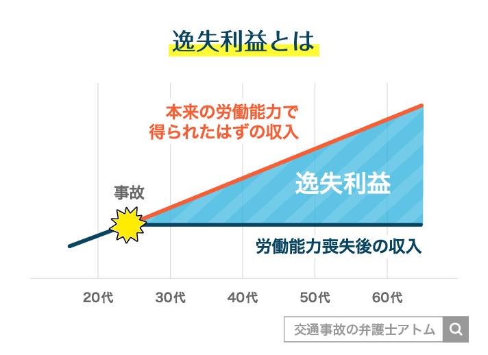 逸失利益とは