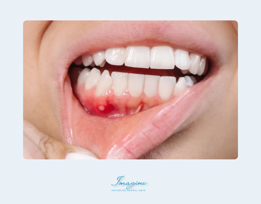 How Diabetes Affects Your Mouth?