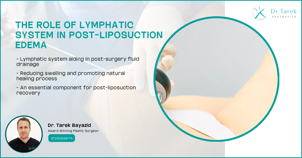 Can Liposuction Cause Edema