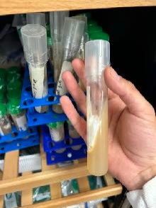 mycelium agar slant tube