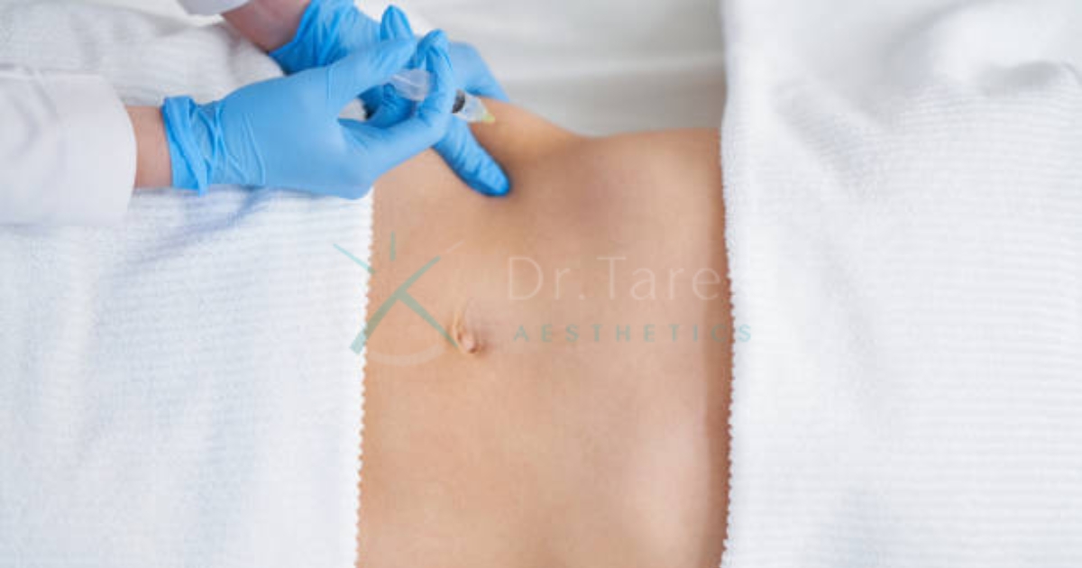 Are Lipo Injections Safe