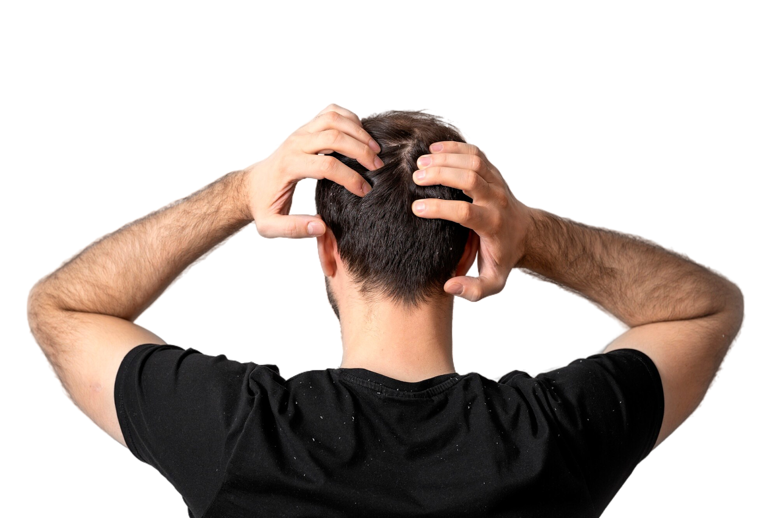 A black t-shirt man having dandruff issues, scalp scratching, dandruff irritation, home remedies for dandruff and scalp itching