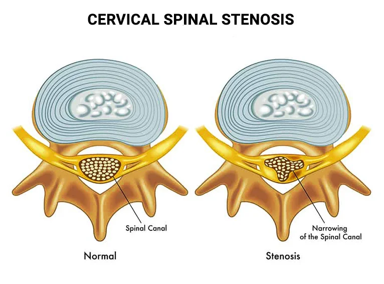 discs of the spine cross section