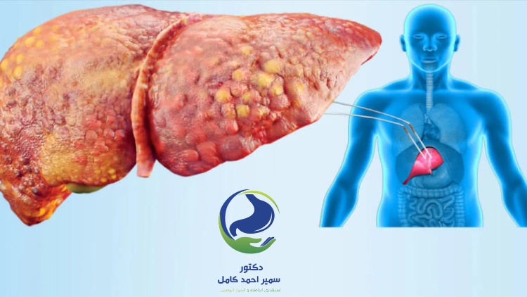 كيفية الوقاية من امراض الكبد