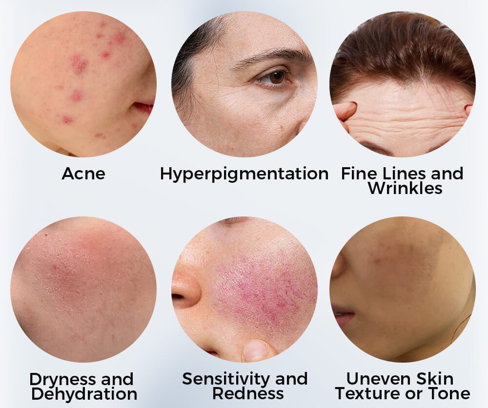 in this image all the skin concerns are highlighted by https://ageology.in/