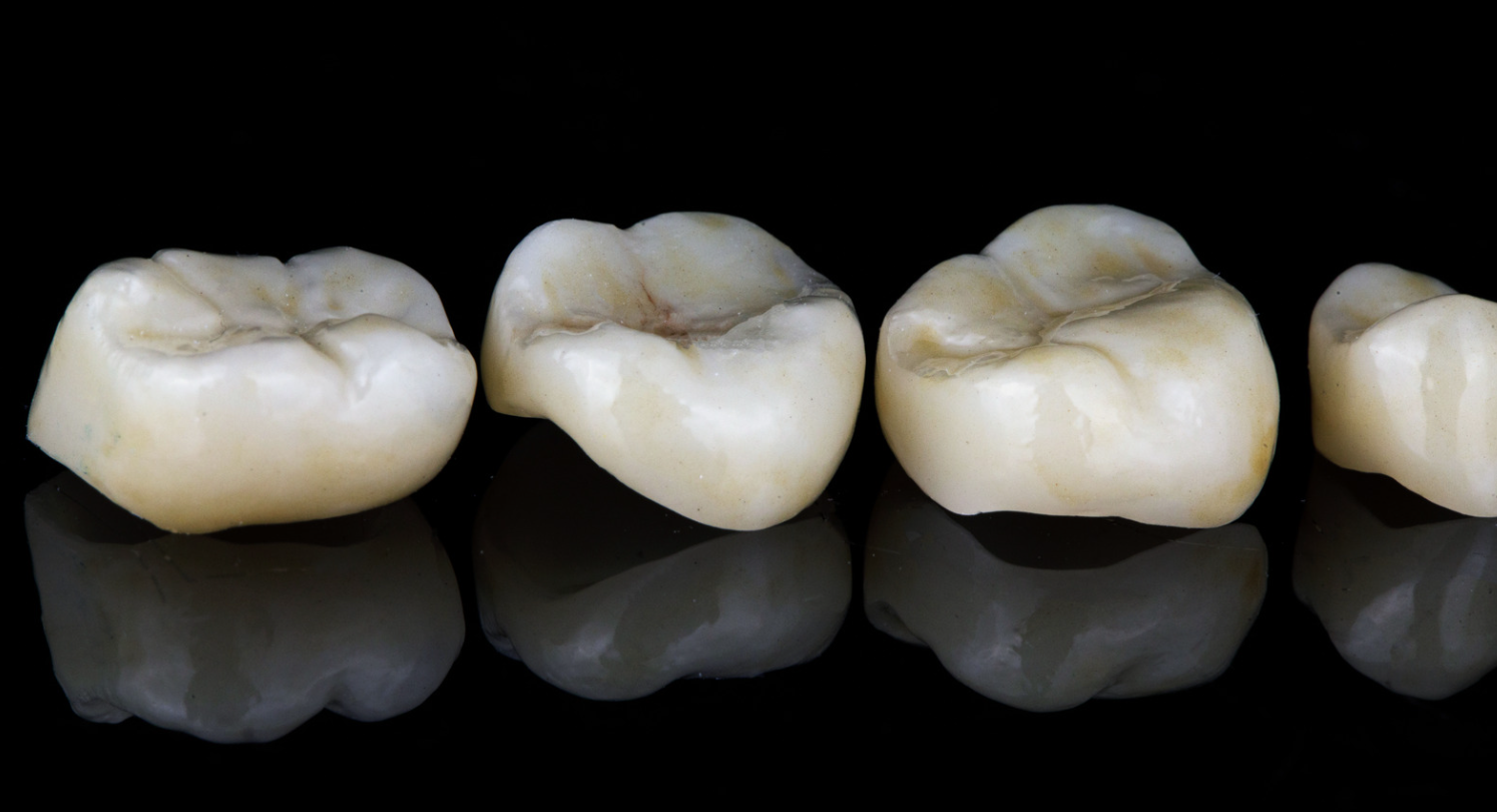 Dental crowns