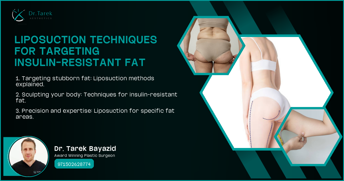 Can Liposuction Help Insulin Resistance