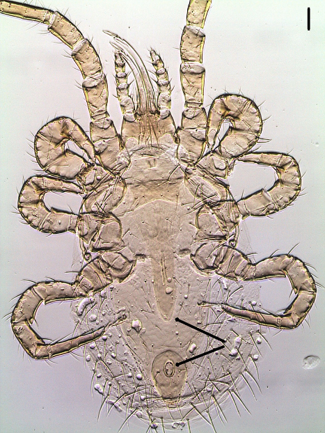 Ventral view of Ornithonyssus bursa adult female showing the posteriorly narrowed genitoventral shield (upper arrow) and the teardrop-shaped anal plate with anal opening at the anterior end (lower arrow). Scale bar: 50 μm.