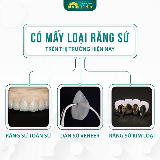 Các loại răng sứ phổ biến hiện nay